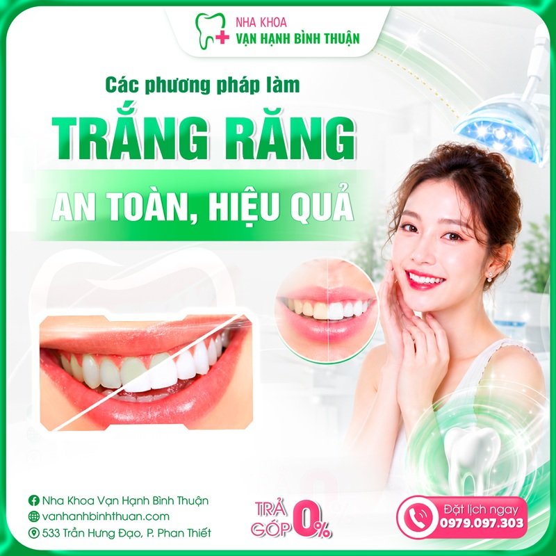 Các phương pháp làm trắng răng an toàn, hiệu quả được ưa chuộng hiện nay